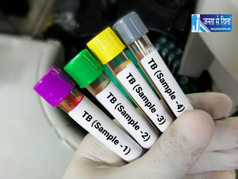 दिल्ली की झुग्गियों में TB मुक्त अभियान की तैयारी दिल्ली की झुग्गियों में TB मुक्त अभियान की तैयारी