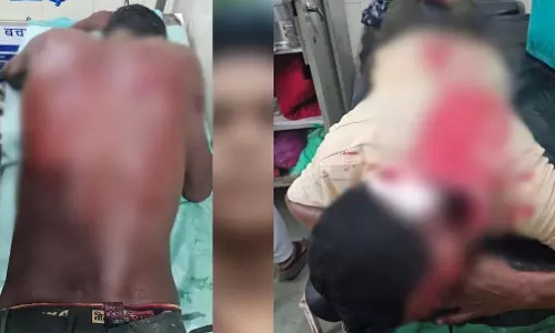 सफाई कर्मचारी ने दो साथियों पर किया टंगिया से हमला, आरोपी गिरफ्तार सफाई कर्मचारी ने दो साथियों पर किया टंगिया से हमला, आरोपी गिरफ्तार