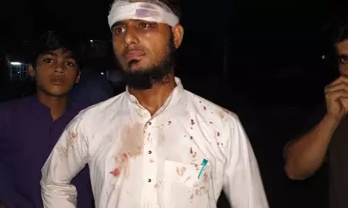 सफर के दौरान दारुल उलूम छात्र से बदसलूकी मामले ने पकड़ा तूल सफर के दौरान दारुल उलूम छात्र से बदसलूकी मामले ने पकड़ा तूल