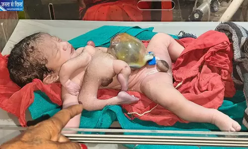 छतरपुर में महिला ने जन्म दिया दुर्लभ नवजात चार हाथ-पैर वाले बच्चे छतरपुर में महिला ने जन्म दिया दुर्लभ नवजात चार हाथ-पैर वाले बच्चे