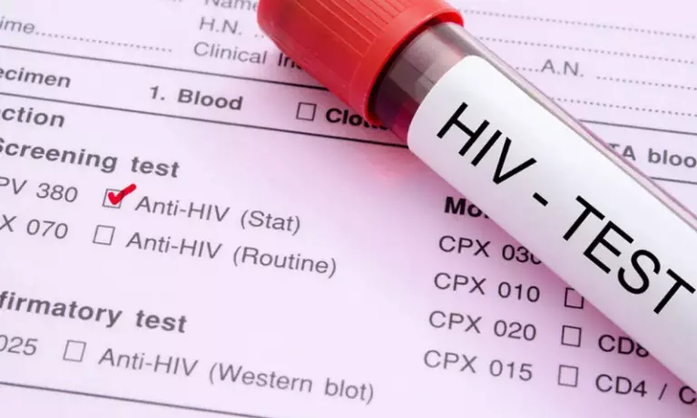 Assam: गुवाहाटी सेंट्रल जेल के 65 से ज़्यादा कैदी HIV पॉज़िटिव पाए गए Assam: गुवाहाटी सेंट्रल जेल के 65 से ज़्यादा कैदी HIV पॉज़िटिव पाए गए