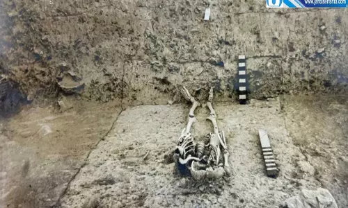 70 साल पुराने कंकाल से खुलेगा काशी का इतिहास BHU वैज्ञानिक करेंगे बड़ा अध्ययन