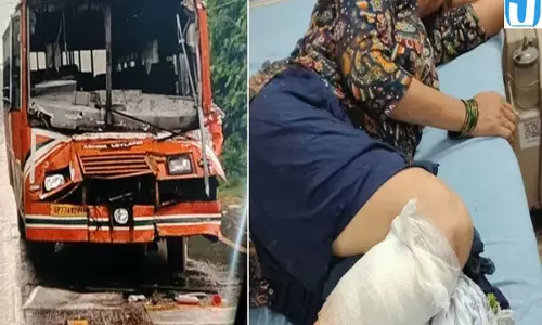 रोडवेज बस दुर्घटनाग्रस्त चालक समेत 18 यात्री घायल