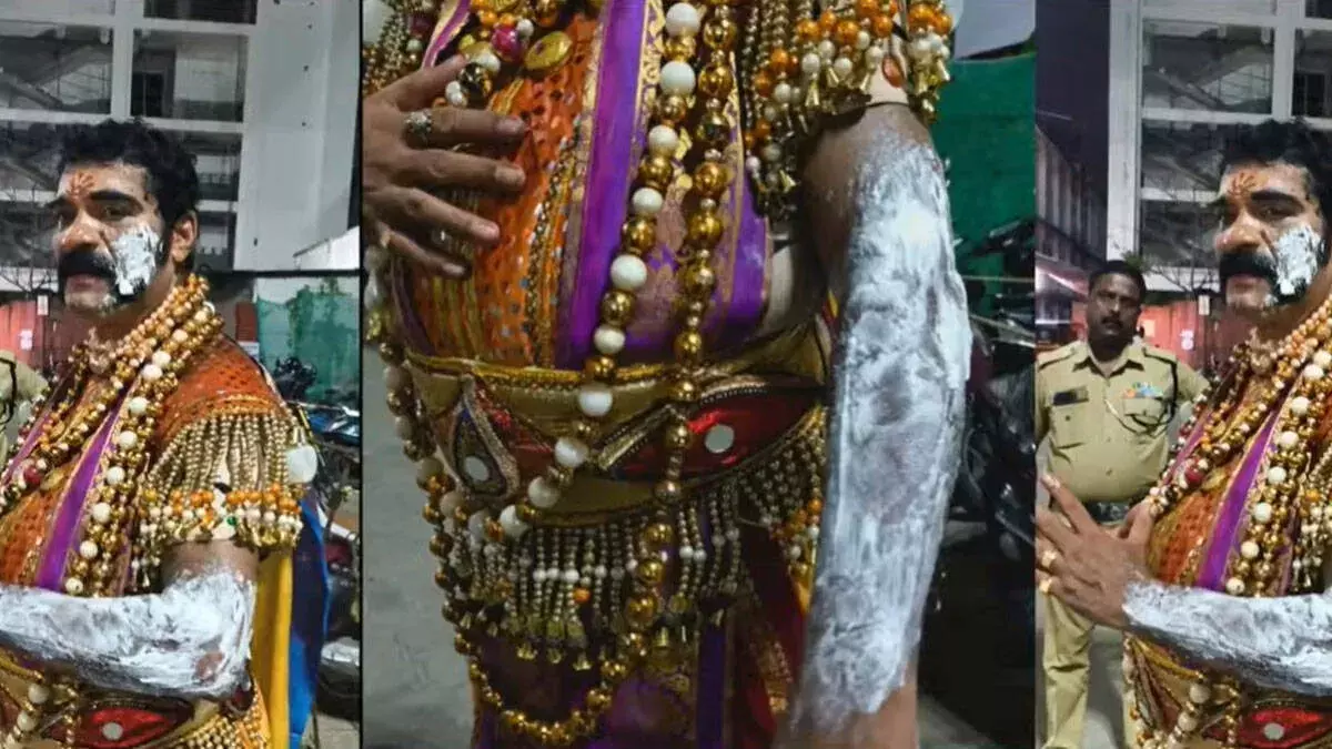 कायमकुलम में मावेली पर खौलता हुआ तेल डाला गया; दुकानदार के खिलाफ शिकायत दर्ज
