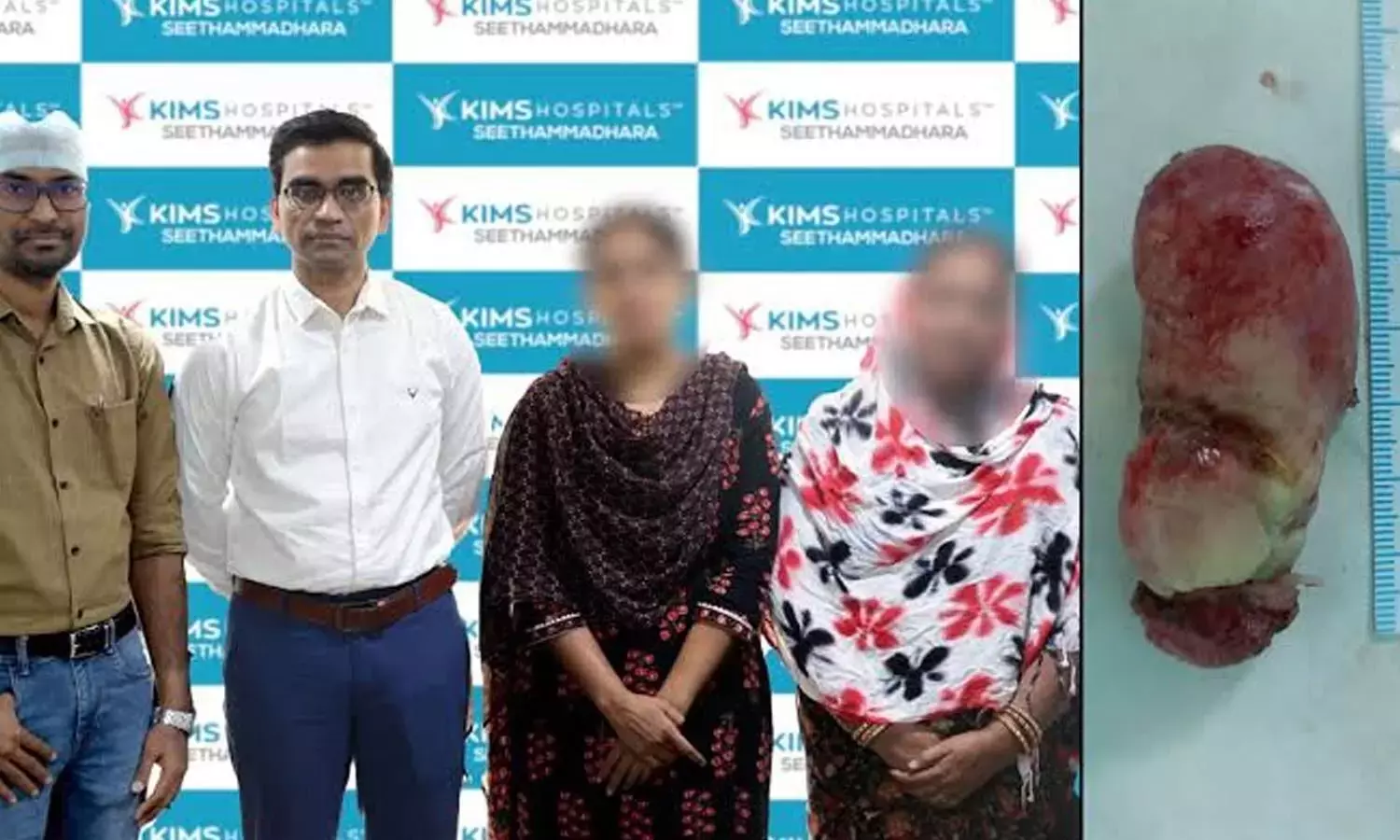 Andhra: डॉक्टरों ने बिना किसी बाहरी चीरे के 6 सेंटीमीटर का एसोफेजियल ट्यूमर निकाला