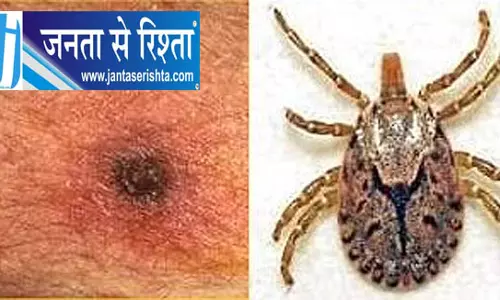 Bhubaneswar ELISA टेस्ट में स्क्रब टाइफस के सभी मामले खारिज