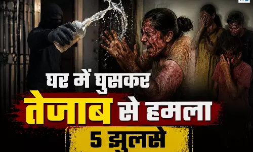 BREAKING: पैसों के विवाद में तेजाब से हमला, एक ही परिवार के पांच लोग झुलसे BREAKING: पैसों के विवाद में तेजाब से हमला, एक ही परिवार के पांच लोग झुलसे