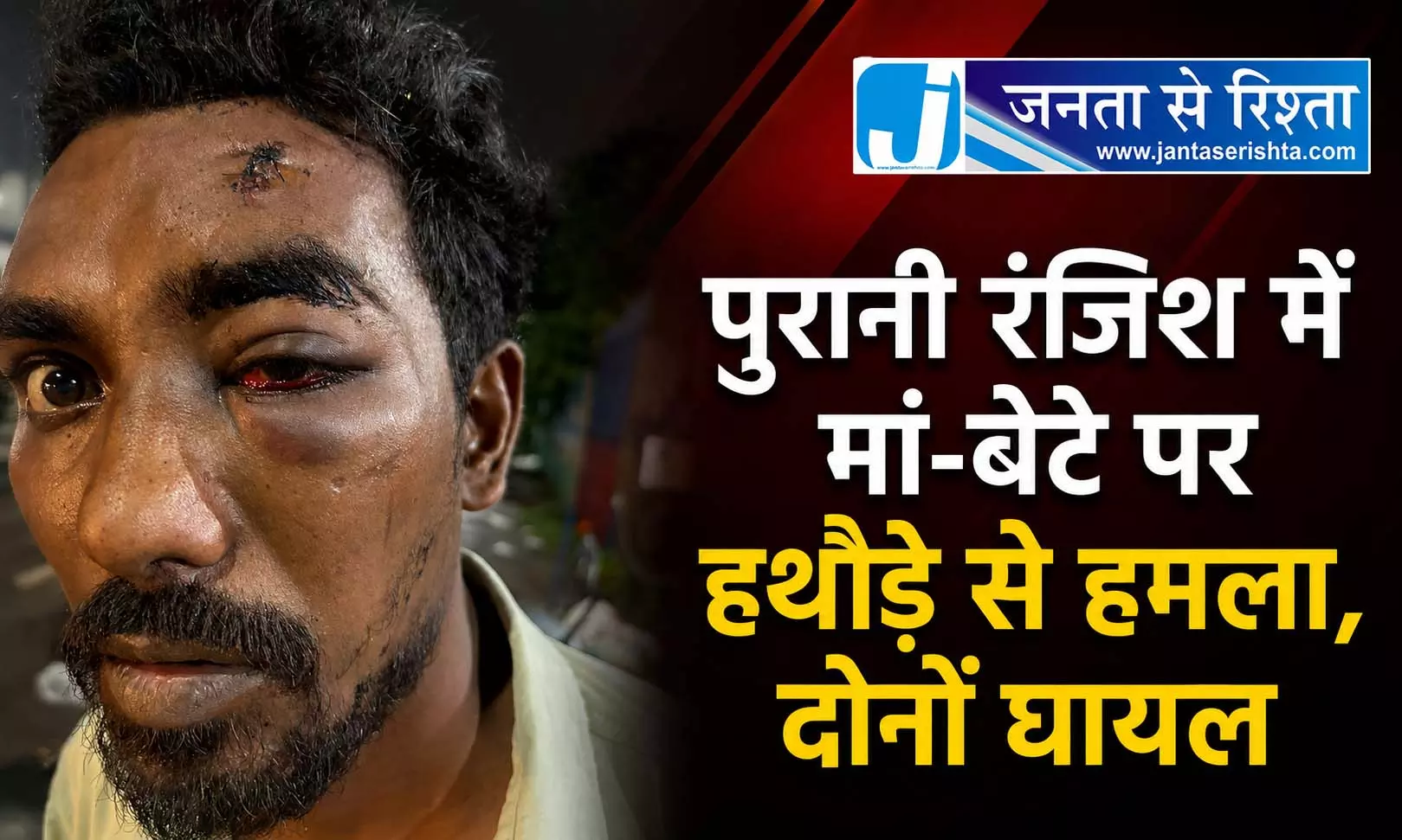 पुरानी रंजिश में मां-बेटे पर हथौड़े से हमला, दोनों घायल पुरानी रंजिश में मां-बेटे पर हथौड़े से हमला, दोनों घायल
