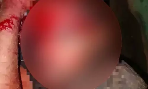 भालुओं के झुंड ने राहगीर पर किया हमला, युवक गंभीर