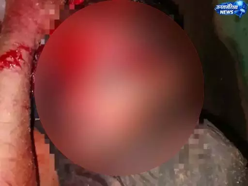 भालुओं के झुंड ने राहगीर पर किया हमला, युवक गंभीर भालुओं के झुंड ने राहगीर पर किया हमला, युवक गंभीर