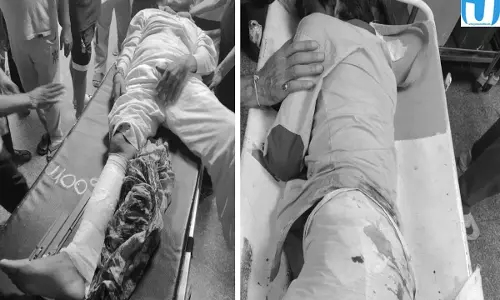 पार्षद कार्यालय के बाहर विवाद के बाद गोलीबारी तीन लोग घायल