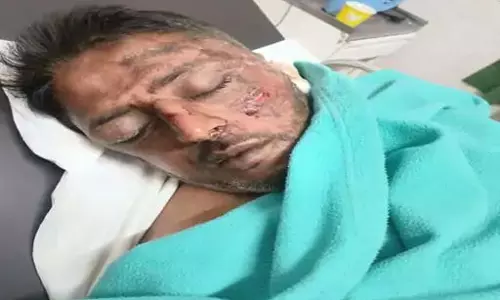 कोरेक्स नाइट्रा बेचने वाले बदमाश का आतंक, बाइक से छोड़ने से मना करने पर मारपीट कोरेक्स नाइट्रा बेचने वाले बदमाश का आतंक, बाइक से छोड़ने से मना करने पर मारपीट