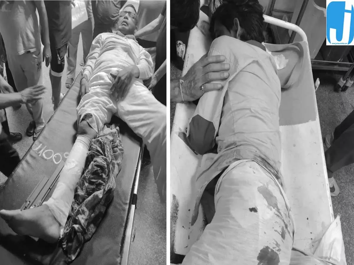 पार्षद कार्यालय के बाहर विवाद के बाद गोलीबारी तीन लोग घायल पार्षद कार्यालय के बाहर विवाद के बाद गोलीबारी तीन लोग घायल
