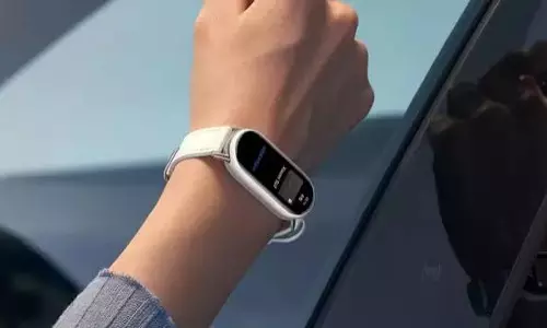 Xiaomi का नया स्मार्ट बैंड: महिलाओं के लिए स्पेशल फीचर्स, 21 दिन की बैटरी