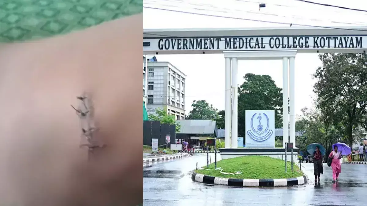 मासूम के शरीर में फंसी सुई: कोट्टायम MCH पर लापरवाही का आरोप मासूम के शरीर में फंसी सुई: कोट्टायम MCH पर लापरवाही का आरोप