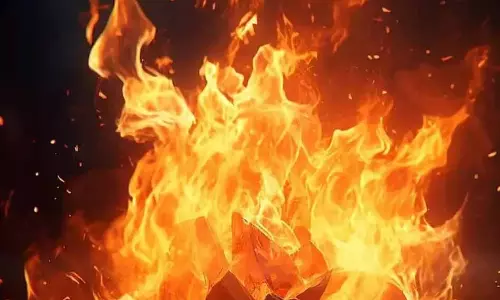 Andhra: अडोनी में दो महिलाओं ने सफाई कर्मचारी पर हमला किया और उसे आग के हवाले कर दिया Andhra: अडोनी में दो महिलाओं ने सफाई कर्मचारी पर हमला किया और उसे आग के हवाले कर दिया
