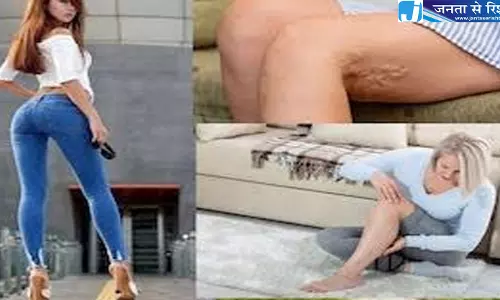 फैशन के चक्कर में सेहत से खिलवाड़ जांघ की नस पर पड़ रहा असर