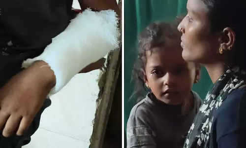 कुत्ते के काटने के बाद 32 लोग पहुंचे अस्पताल, दो बच्चे भर्ती; चार महीने में 3292 मामले कुत्ते के काटने के बाद 32 लोग पहुंचे अस्पताल, दो बच्चे भर्ती; चार महीने में 3292 मामले