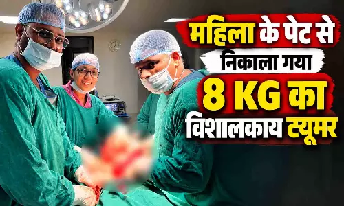 8 KG का ट्यूमर देखकर डॉक्टर भी रह गए हैरान, महिला का सफल ऑपरेशन कर दी नई जिंदगी