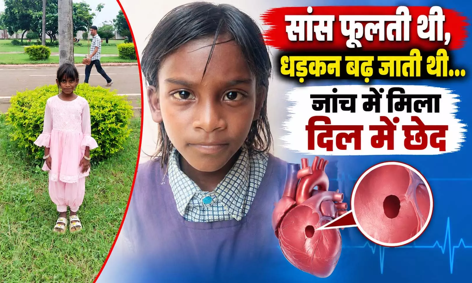 सांस फूलती थी, धड़कन बढ़ जाती थी...जांच में मिला दिल में छेद, बिना ओपन हार्ट सर्जरी के हुआ इलाज सांस फूलती थी, धड़कन बढ़ जाती थी...जांच में मिला दिल में छेद, बिना ओपन हार्ट सर्जरी के हुआ इलाज
