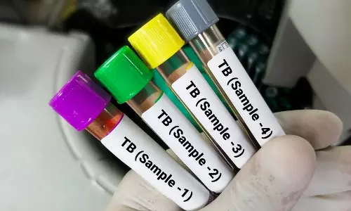 AI मैपिंग से सामने आई TB की तस्वीर, दिल्ली में 1.75 लाख मरीजों की पहचान AI मैपिंग से सामने आई TB की तस्वीर, दिल्ली में 1.75 लाख मरीजों की पहचान