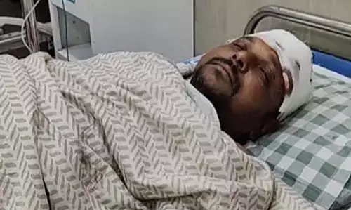 पार्षद पर जानलेवा हमला, झगड़ा छुड़ाने पहुंचे थे आरोपी ने सिर पर किया वार