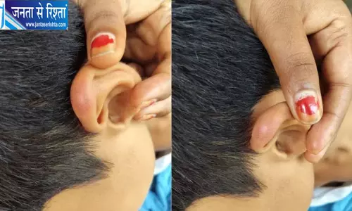 गोरखपुर स्कूल में बच्चों से मारपीट का आरोप