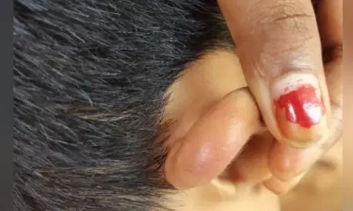 स्कूल में सजा या सितम! प्लास से खींचे कान हथौड़े से मारी चोट, शिक्षक पर गंभीर आरोप