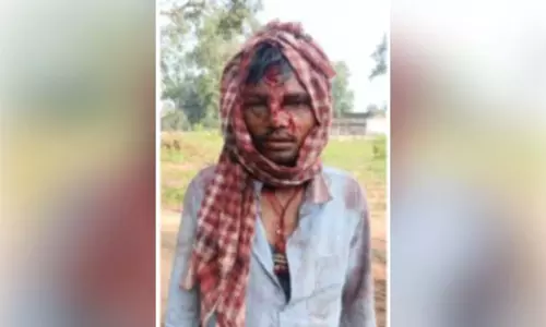 जंगल में मौत से सामना! अचानक सामने आए 4 भालू, फिर...