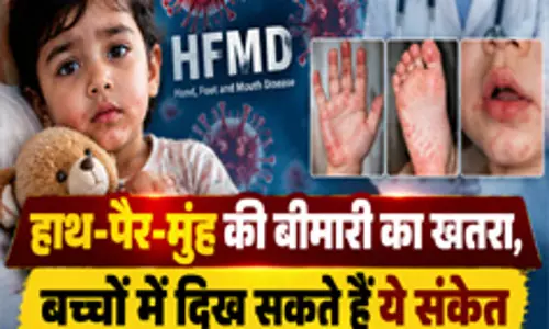 हाथ पैर मुंह की बीमारी का खतरा बच्चों में दिख सकते हैं ये संकेत