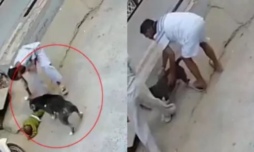 खूंखार पिटबुल ने 6 महीने के बच्चे पर किया हमला, बुआ की गोद में था, लगे 20 टांके खूंखार पिटबुल ने 6 महीने के बच्चे पर किया हमला, बुआ की गोद में था, लगे 20 टांके