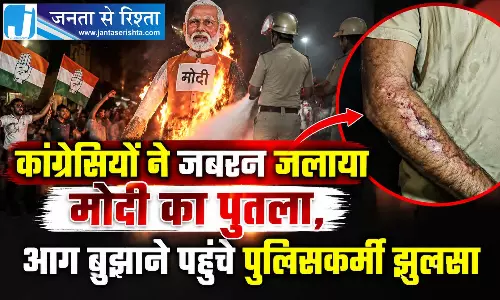 कांग्रेसियों ने जबरन जलाया मोदी का पुतला, आग बुझाने पहुंचे पुलिसकर्मी झुलसा
