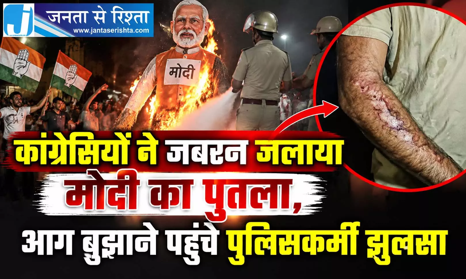 कांग्रेसियों ने जबरन जलाया मोदी का पुतला, आग बुझाने पहुंचे पुलिसकर्मी झुलसा कांग्रेसियों ने जबरन जलाया मोदी का पुतला, आग बुझाने पहुंचे पुलिसकर्मी झुलसा