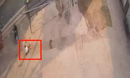 कुत्ते ने 31 लोगों को काटा, इलाके में फैली दहशत