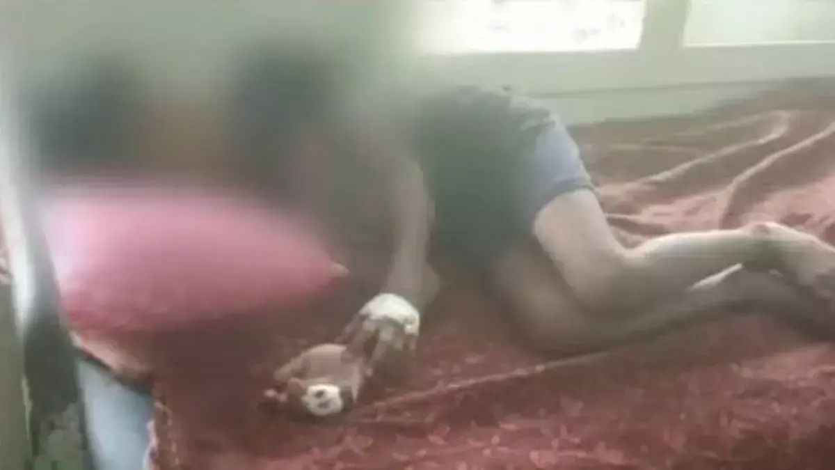 नागरूर में आवारा कुत्ते के हमले में एक लड़के की उंगली कट गई नागरूर में आवारा कुत्ते के हमले में एक लड़के की उंगली कट गई