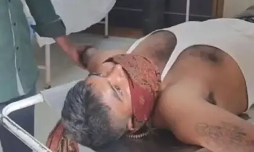 कुत्ते के काटने की बात परिवार से छिपाई, पानी देखते ही गुर्राने लगा युवक; अस्पताल में कराया भर्ती