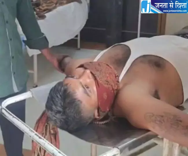 कुत्ते के काटने की बात परिवार से छिपाई, पानी देखते ही गुर्राने लगा युवक; अस्पताल में कराया भर्ती कुत्ते के काटने की बात परिवार से छिपाई, पानी देखते ही गुर्राने लगा युवक; अस्पताल में कराया भर्ती