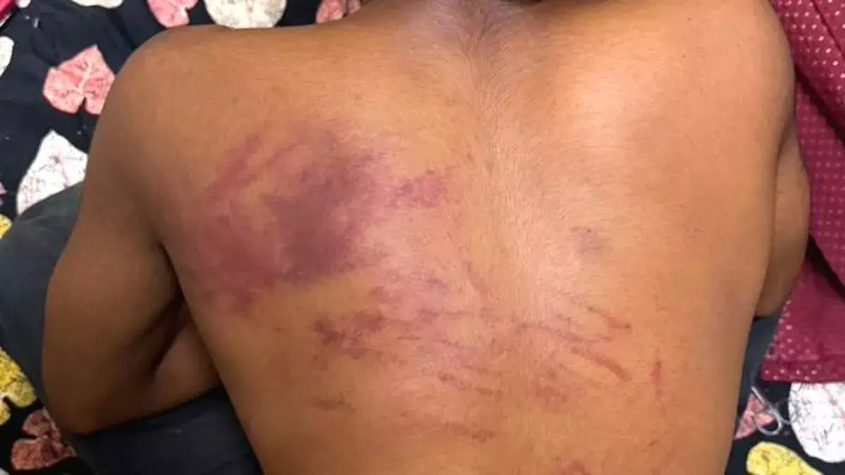 चेन्नई में सीनियर्स ने मलयाली छात्र के साथ बेरहमी से रैगिंग की, मामला दर्ज चेन्नई में सीनियर्स ने मलयाली छात्र के साथ बेरहमी से रैगिंग की, मामला दर्ज