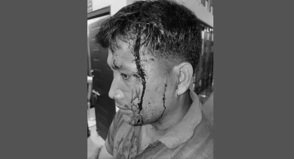 असम: चाय बागान में चोरी रोकने पर किसान धनीराम घायल असम: चाय बागान में चोरी रोकने पर किसान धनीराम घायल