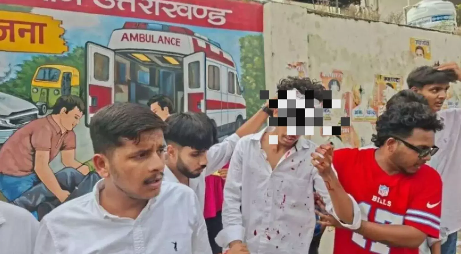 एमबीपीजी कॉलेज में वोटिंग के बाद छात्र गुट आमने-सामने, एक घायल एमबीपीजी कॉलेज में वोटिंग के बाद छात्र गुट आमने-सामने, एक घायल