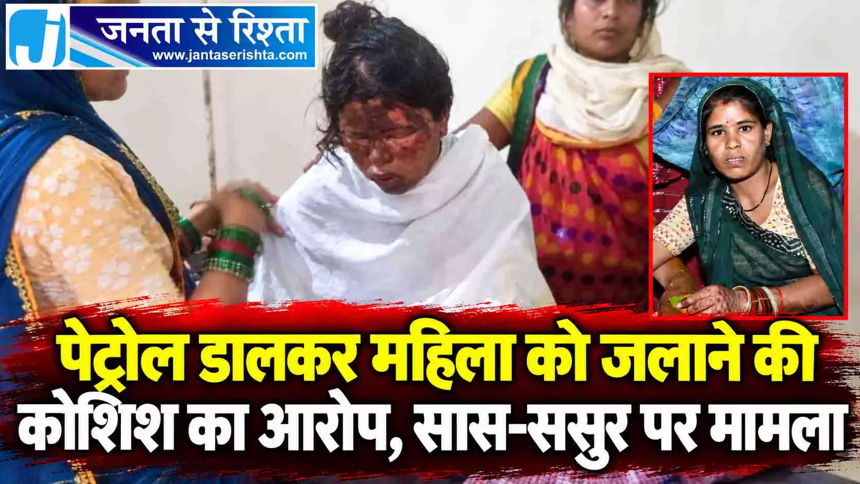 पेट्रोल डालकर महिला को जलाने की कोशिश का आरोप, सास-ससुर पर मामला पेट्रोल डालकर महिला को जलाने की कोशिश का आरोप, सास-ससुर पर मामला