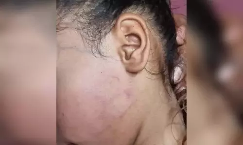 राज्यपाल सम्मान प्राप्त शिक्षक पर छात्रा की पिटाई का आरोप, कार्रवाई की उठी मांग राज्यपाल सम्मान प्राप्त शिक्षक पर छात्रा की पिटाई का आरोप, कार्रवाई की उठी मांग