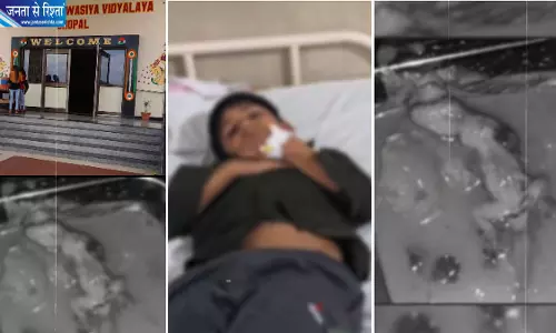 हॉस्टल की सब्जी में मरी छिपकली मिलने का दावा, 13 छात्र बीमार, स्कूल प्रशासन पर उठे सवाल