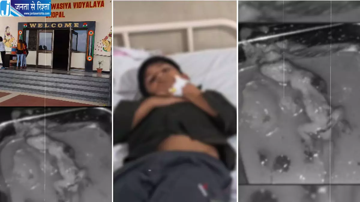 हॉस्टल की सब्जी में मरी छिपकली मिलने का दावा, 13 छात्र बीमार, स्कूल प्रशासन पर उठे सवाल हॉस्टल की सब्जी में मरी छिपकली मिलने का दावा, 13 छात्र बीमार, स्कूल प्रशासन पर उठे सवाल