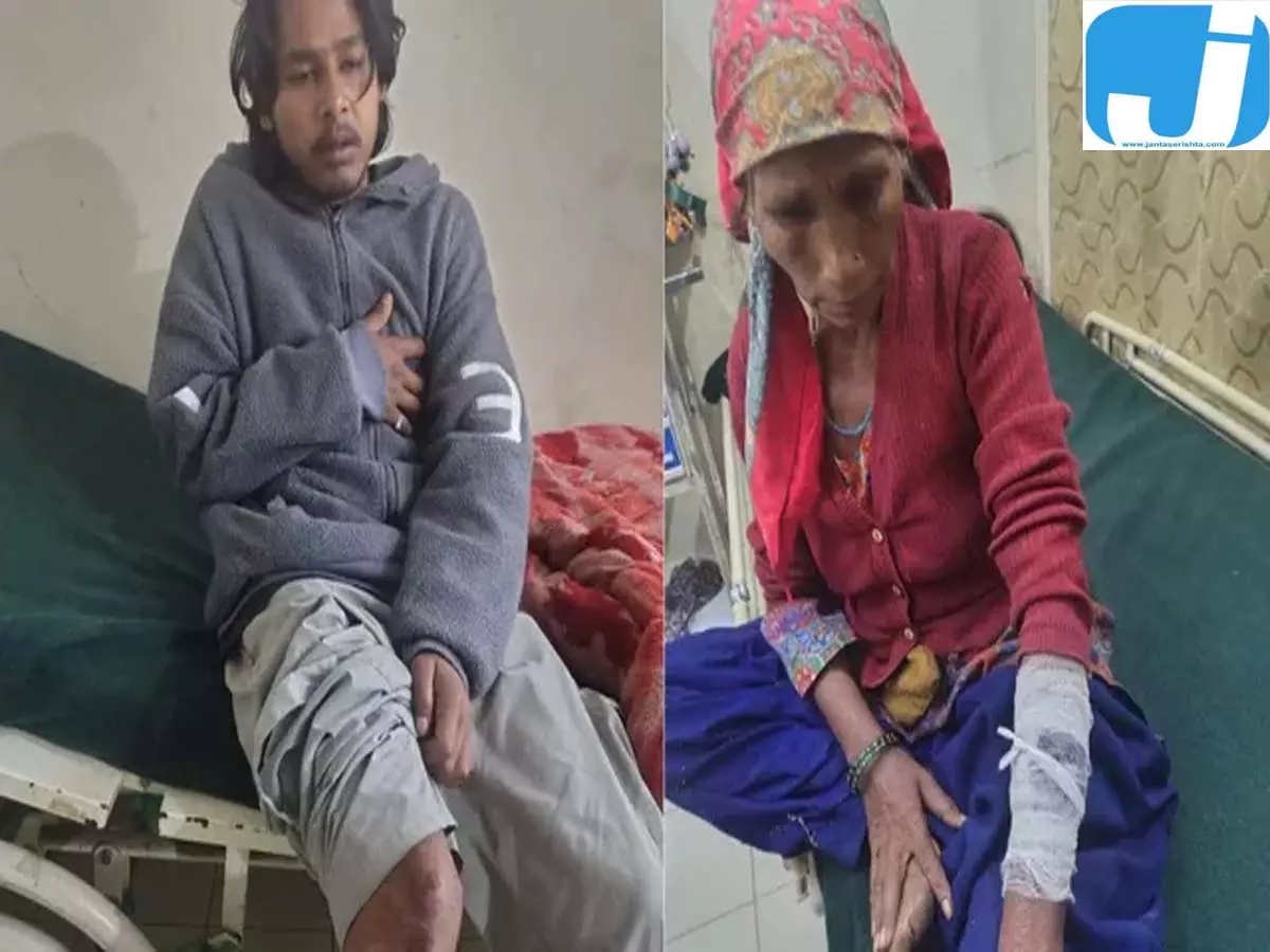 भालू के हमले से जोशीमठ में दहशत, चार लोगों को किया घायल भालू के हमले से जोशीमठ में दहशत, चार लोगों को किया घायल
