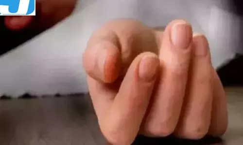 राप्तीनगर अग्निकांड ने ली दंपति की जान, नौकरानी की हालत नाजुक
