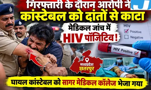 रेप के आरोपी ने पुलिसकर्मी को दांतों से काटा, मेडिकल जांच में HIV पॉजिटिव; पुलिसकर्मी अस्पताल पहुंचा