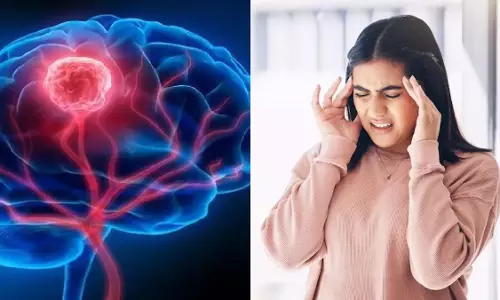 बार-बार भूलना और सिरदर्द, हो सकती है गंभीर समस्या बार-बार भूलना और सिरदर्द, हो सकती है गंभीर समस्या