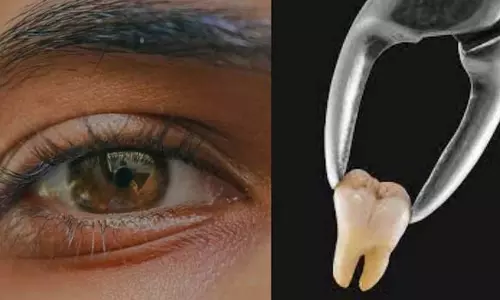 दांत निकलने की ऐसी जगह आपने कभी नहीं सुनी होगी, डॉक्टरों ने सर्जरी कर निकाला