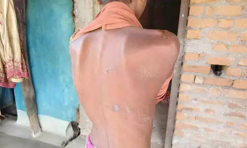 10 दिनों से लापता बेटे को देख भावुक हुए परिजन, शरीर पर मिले चोट के निशान